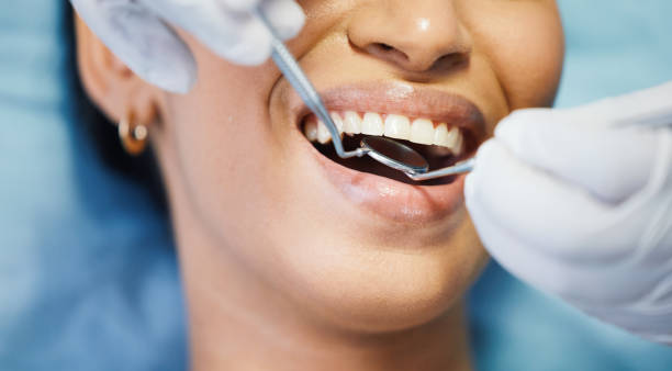 Best Knocked-Out Tooth Emergency  in Townsend, MT